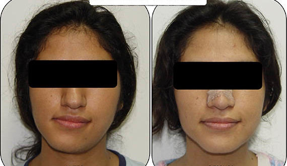 malformacion malformacion